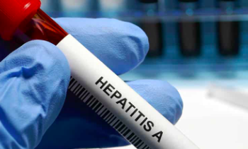 Tras 4 días del brote de Hepatitis A siguen sin localizar foco de infección