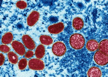 La viruela del mono, ¿qué es y como se transmite?