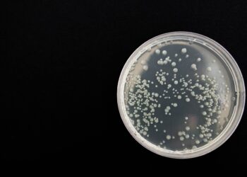 Aumenta a 17 el número de menores muertos por bacteria Klebsiella oxytoca. Foto de Pixabay